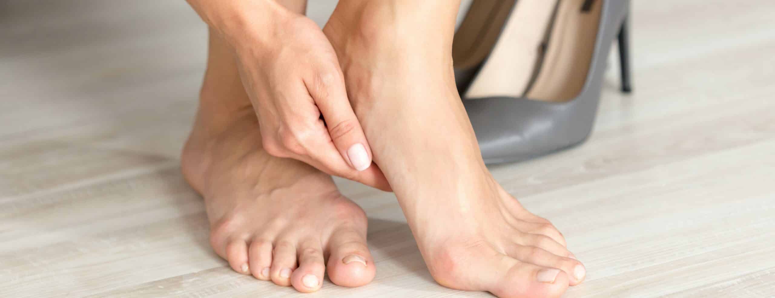 Comment vivre avec les pieds creux ? |Dr Polle | Normandie